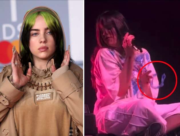 Billie Eilish Was Hit In The Face With A Bracelet Thrown By Fan